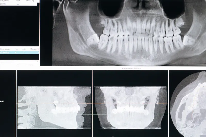 Panoramic dental X-ray and scan images on a clinic screen